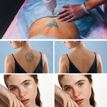 Load image into Gallery viewer, Niansheng  Eyebrow Tattoo Removal Machine ND-YAG Laser Beauty Equipment