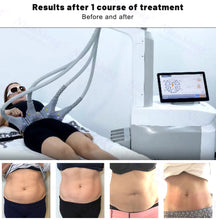 Load image into Gallery viewer, 1060nm diode laser slimming