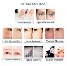Load image into Gallery viewer, Hottest 4 in 1 E-light Ipl Rf Nd Yag Laser Multifunction Hair Removal Machine