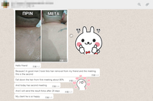 Load image into Gallery viewer, Niansheng E Light+IPL+RF+ND YAG Laser Opt Shr Hair Removal Face Lifting Tattoo Removal Machine