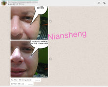 Load image into Gallery viewer, Niansheng E Light+IPL+RF+ND YAG Laser Opt Shr Hair Removal Face Lifting Tattoo Removal Machine