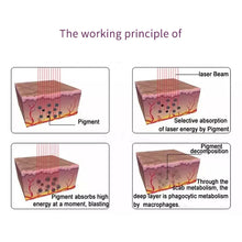 Load image into Gallery viewer, Pigment Treatment Laser Tattoo Removal Machine Skin Care Q-Switch Laser for Tattoo/Pigment/Acne/Mole Removal Laser Beauty Salon Equipment