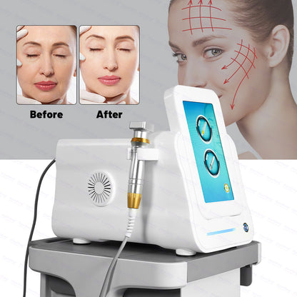 Portable Fractional RF Microneedling Machine | Radio Frequency Micro-Needle Skin Rejuvenation System