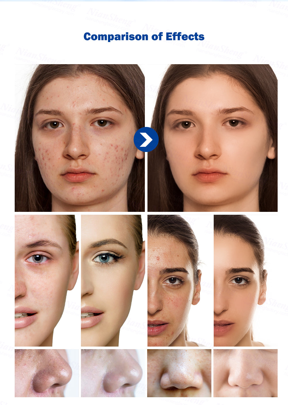 9 in 1 Multifunctional Dermabrasion Facial Deep Clean Machine Skin Moisturizing Face Lifting Beauty Facial Dermabrasion Machine