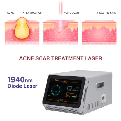 1940nm Diode Laser System for EVLT EVLA Professional Endovenous Vein Laser Ablation Device
