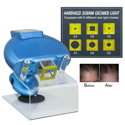 Niansheng Portable Home use excimer laser Mini 308nm psoriasis device For Vitiligo Treatment Excimer Laser