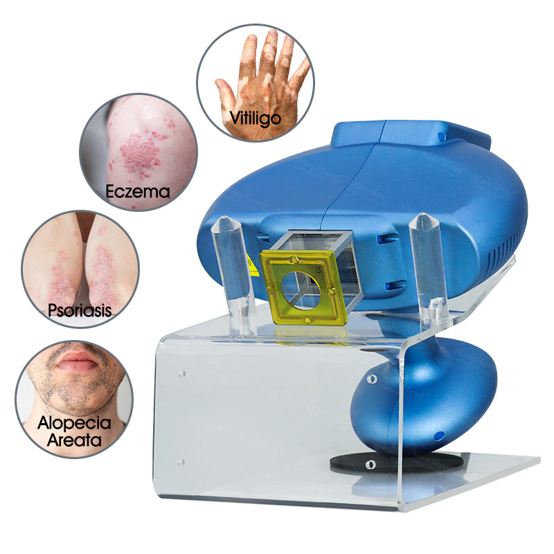Niansheng Portable Home use excimer laser Mini 308nm psoriasis device For Vitiligo Treatment Excimer Laser