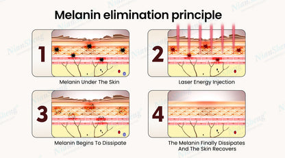 Professional Standing 2026 Picosecond Laser 532-785-1064Nm Tattoo Removal Hair Removal Machine Nd Yag Commercial Use