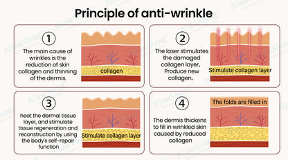 Professional Standing 2026 Picosecond Laser 532-785-1064Nm Tattoo Removal Hair Removal Machine Nd Yag Commercial Use