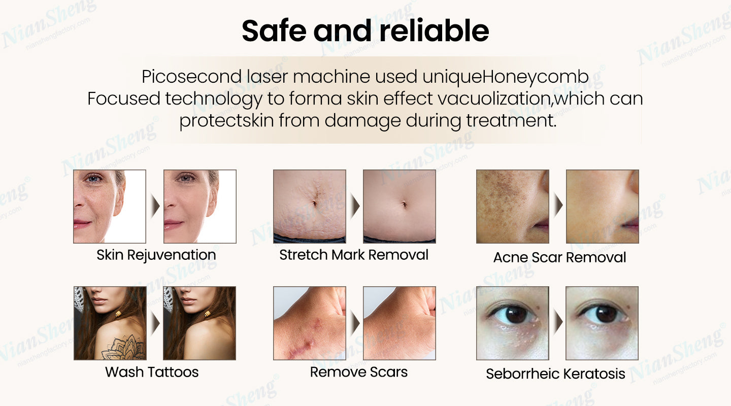 Professional Standing 2026 Picosecond Laser 532-785-1064Nm Tattoo Removal Hair Removal Machine Nd Yag Commercial Use