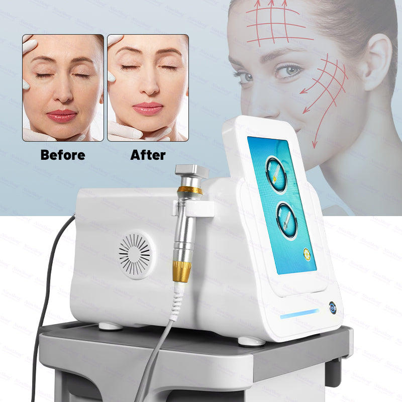 A Niansheng Portable Fractional RF Microneedle +Radio Frequency Skin Tightening Scarlet Rf Microneedling Machine