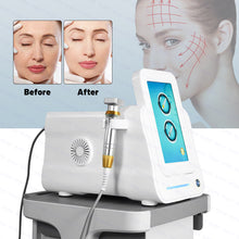 Load image into Gallery viewer, A Niansheng Portable Fractional RF Microneedle +Radio Frequency Skin Tightening Scarlet Rf Microneedling Machine
