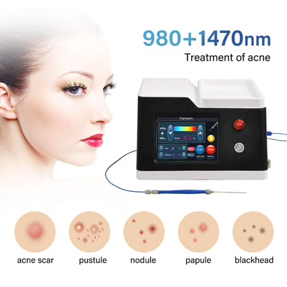 980nm 1470nm Diode Laser Machine for Endolaser Lipolysis Fungus Nail Treatment and Physiotherapy