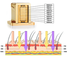 Load image into Gallery viewer, 808 Soprano Diode Laser Hair Removal Machine with Big Spot
