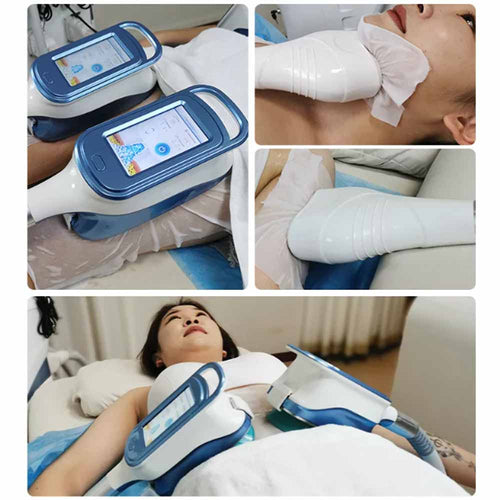 360 Cryolipolysis Cryo lipolaser rf Vacuum Caitation