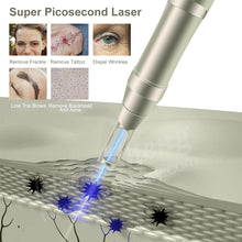 Load image into Gallery viewer, Picolaser q Switch Nd Yag Laser Picosecond Laser Pico Laser Pigment Tattoo Removal Machine
