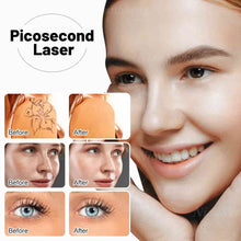 Load image into Gallery viewer, Picosure Pico Way picoway PICO picosure picosecond pico laser picolaser
